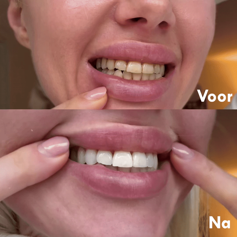 Purple Whitening Toothpaste - DopeSmile