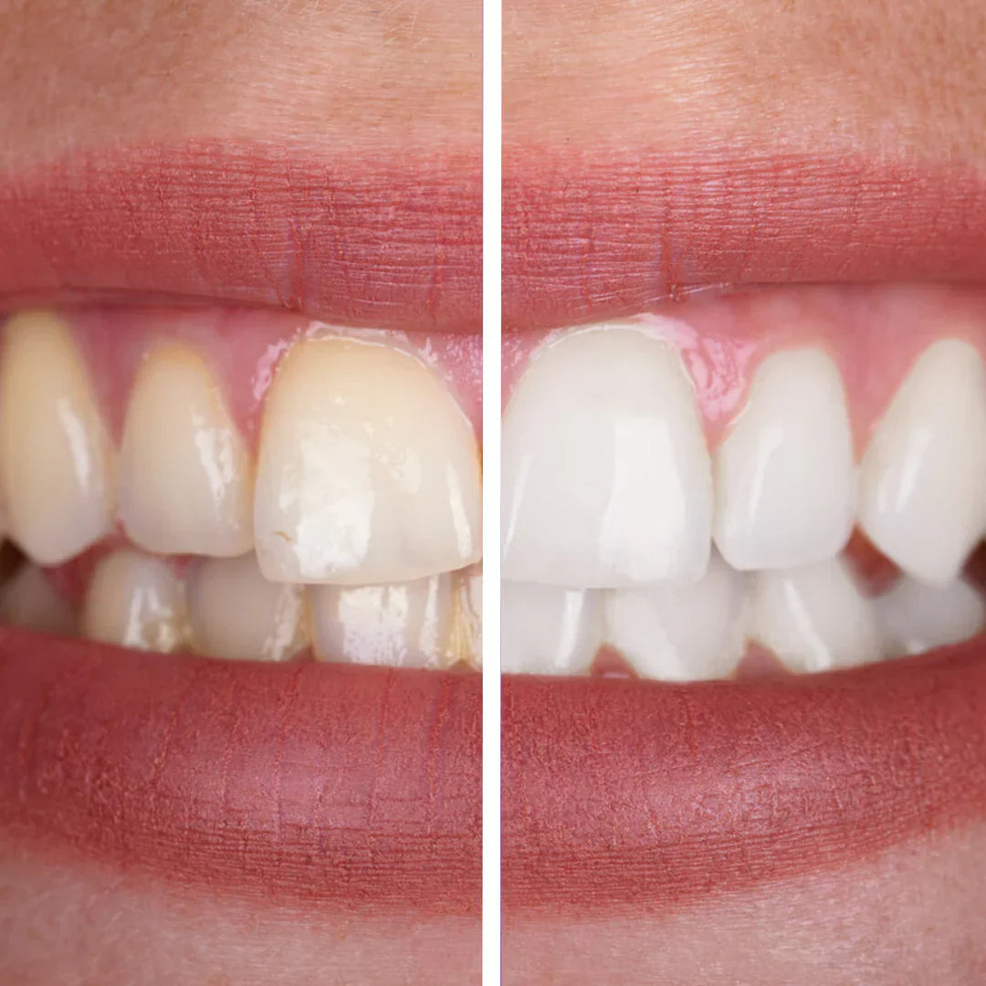 Purple Whitening Toothpaste - DopeSmile